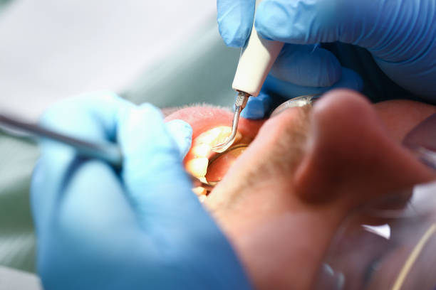 Best Cosmetic Emergency Dentistry in New Iberia, LA